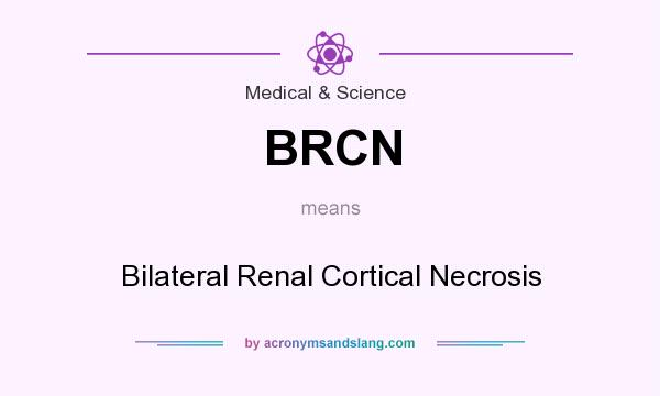 What does BRCN mean? It stands for Bilateral Renal Cortical Necrosis