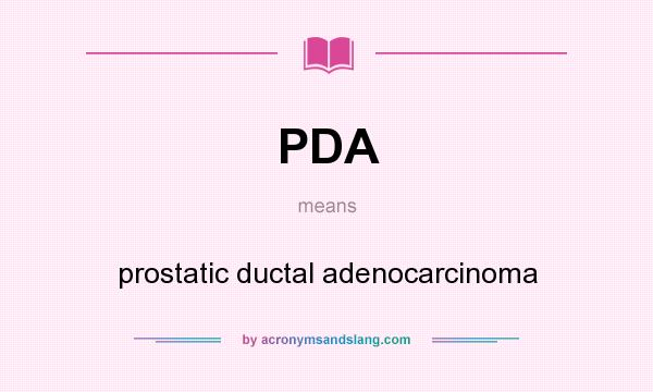 What does PDA mean? It stands for prostatic ductal adenocarcinoma