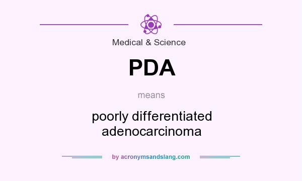 What does PDA mean? It stands for poorly differentiated adenocarcinoma