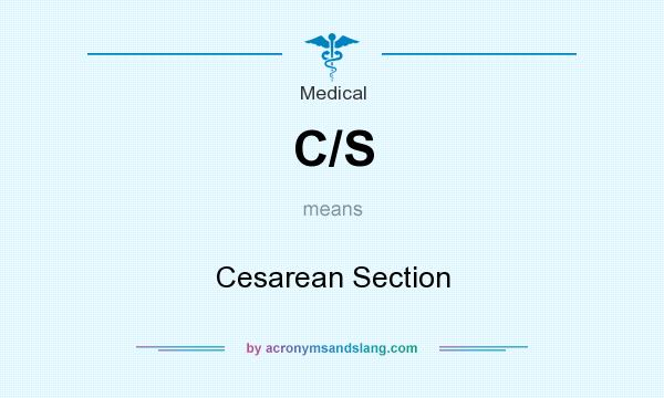 What does C/S mean? It stands for Cesarean Section