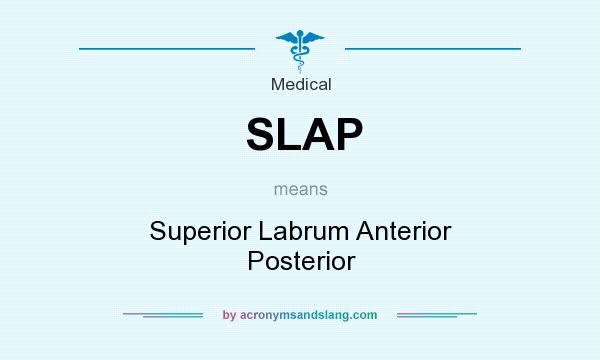 What does SLAP mean? It stands for Superior Labrum Anterior Posterior