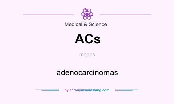 What does ACs mean? It stands for adenocarcinomas