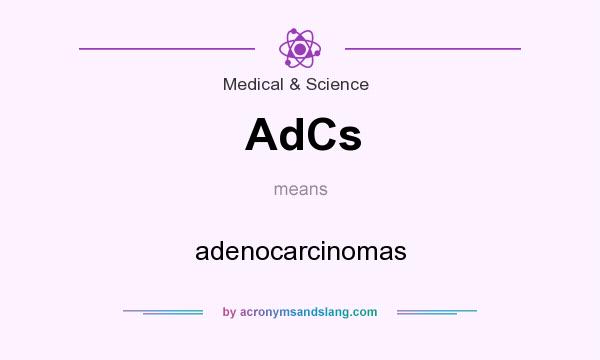 What does AdCs mean? It stands for adenocarcinomas