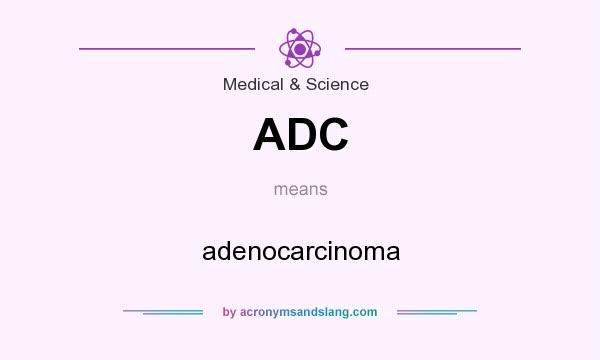 What does ADC mean? It stands for adenocarcinoma