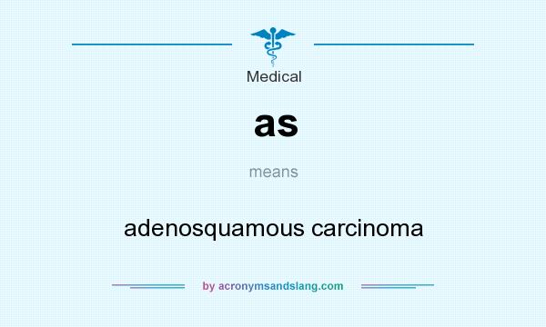What does as mean? It stands for adenosquamous carcinoma