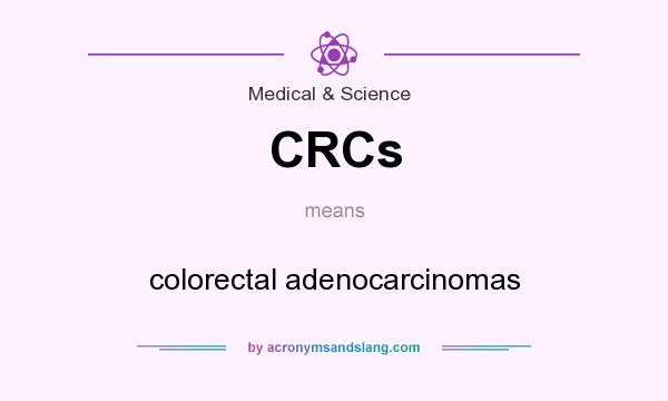 What does CRCs mean? It stands for colorectal adenocarcinomas
