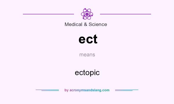 What does ect mean? It stands for ectopic