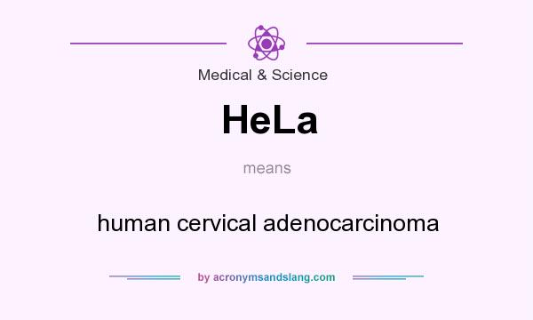 What does HeLa mean? It stands for human cervical adenocarcinoma