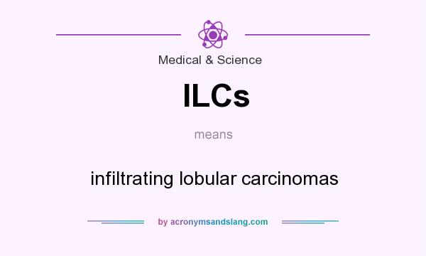 What does ILCs mean? It stands for infiltrating lobular carcinomas