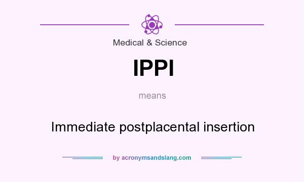 What does IPPI mean? It stands for Immediate postplacental insertion