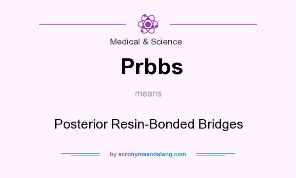 What does Prbbs mean? It stands for Posterior Resin-Bonded Bridges