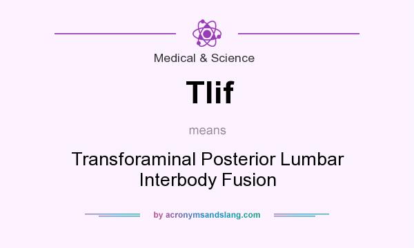 What does Tlif mean? It stands for Transforaminal Posterior Lumbar Interbody Fusion