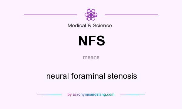 What does NFS mean? It stands for neural foraminal stenosis