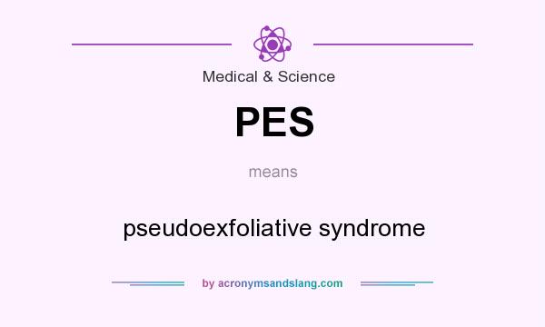 What does PES mean? It stands for pseudoexfoliative syndrome