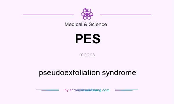What does PES mean? It stands for pseudoexfoliation syndrome