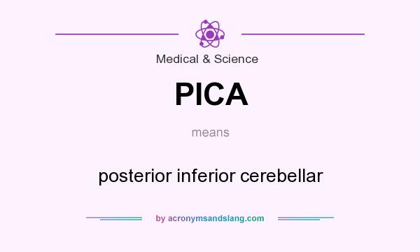What does PICA mean? It stands for posterior inferior cerebellar