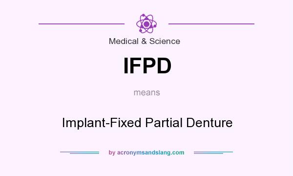 What does IFPD mean? It stands for Implant-Fixed Partial Denture