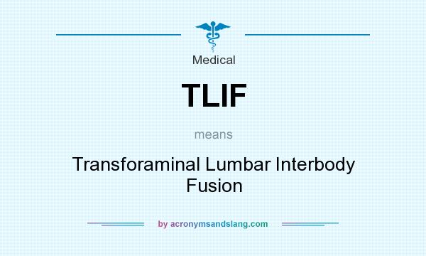 What does TLIF mean? It stands for Transforaminal Lumbar Interbody Fusion