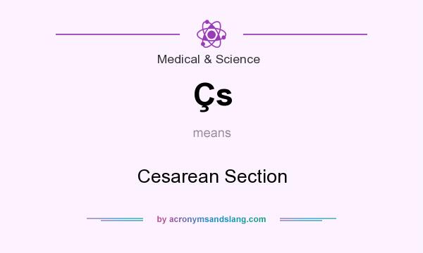 What does Çs mean? It stands for Cesarean Section