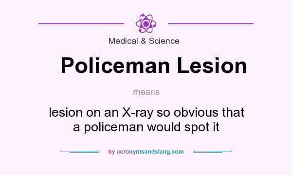 What does Policeman Lesion mean? It stands for lesion on an X-ray so obvious that a policeman would spot it