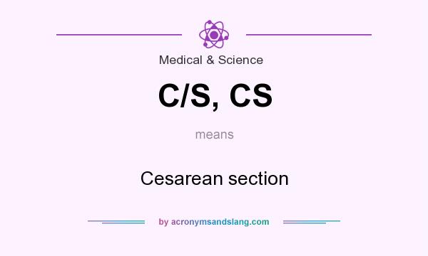 What does C/S, CS mean? It stands for Cesarean section