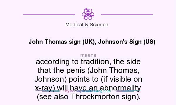 What does John Thomas sign (UK), Johnson`s Sign (US) mean? It stands for according to tradition, the side that the penis (John Thomas, Johnson) points to (if visible on x-ray) will have an abnormality (see also Throckmorton sign).