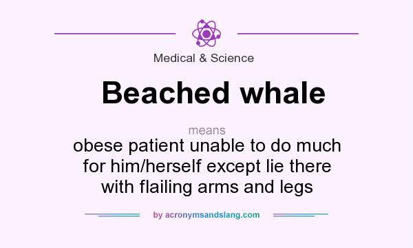 What does Beached whale mean? It stands for obese patient unable to do much for him/herself except lie there with flailing arms and legs