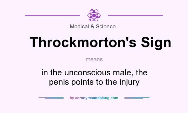 What does Throckmorton`s Sign mean? It stands for in the unconscious male, the penis points to the injury