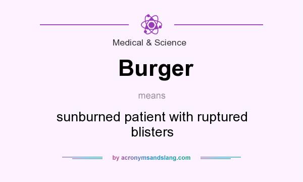 What does Burger mean? It stands for sunburned patient with ruptured blisters