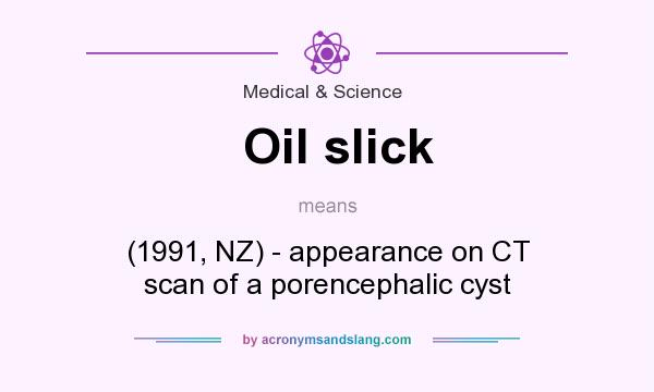 What does Oil slick mean? It stands for (1991, NZ) - appearance on CT scan of a porencephalic cyst