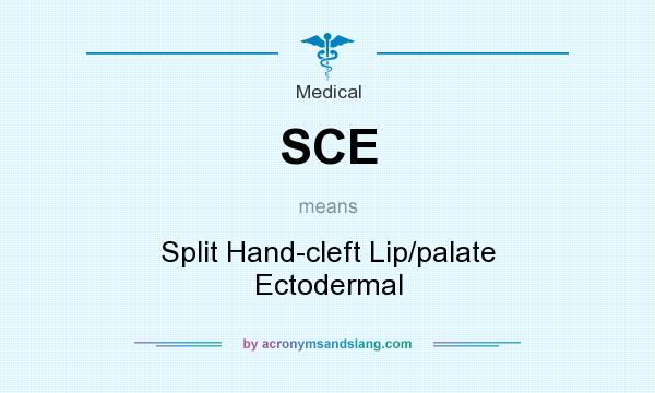 What does SCE mean? It stands for Split Hand-cleft Lip/palate Ectodermal