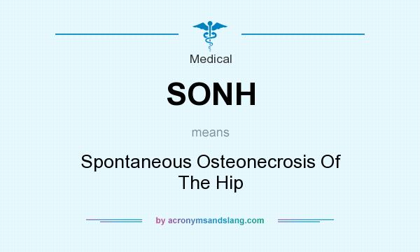 What does SONH mean? It stands for Spontaneous Osteonecrosis Of The Hip