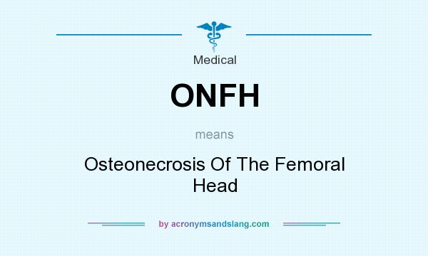 What does ONFH mean? It stands for Osteonecrosis Of The Femoral Head