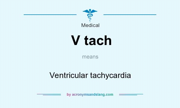 What does V tach mean? It stands for Ventricular tachycardia