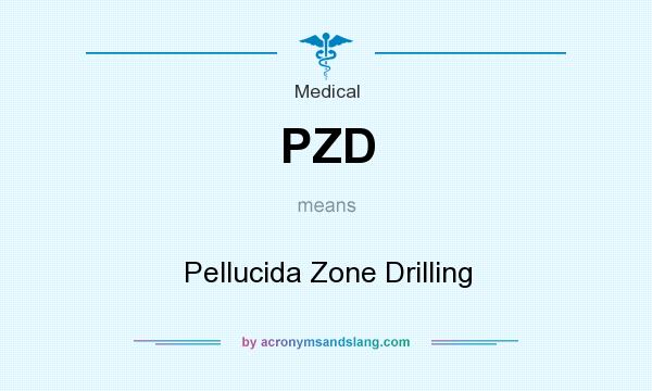 What does PZD mean? It stands for Pellucida Zone Drilling