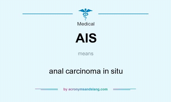 What does AIS mean? It stands for anal carcinoma in situ