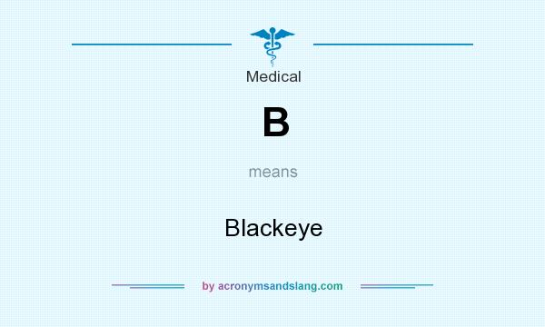 What does B mean? It stands for Blackeye