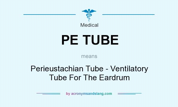 What does PE TUBE mean? It stands for Perieustachian Tube - Ventilatory Tube For The Eardrum