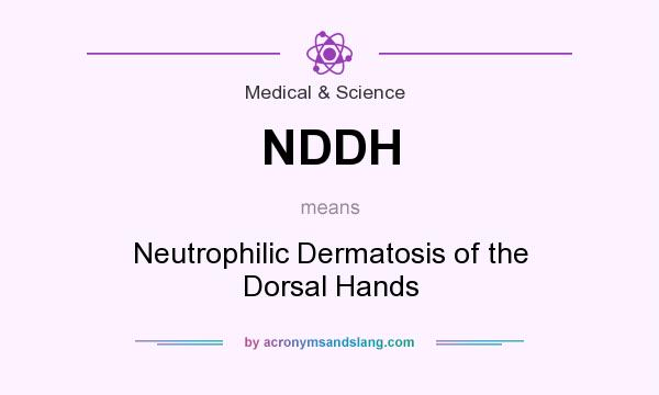 What does NDDH mean? It stands for Neutrophilic Dermatosis of the Dorsal Hands