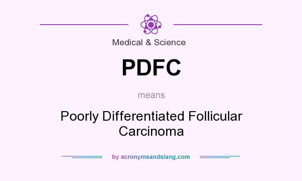 What does PDFC mean? It stands for Poorly Differentiated Follicular Carcinoma