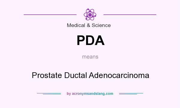 What does PDA mean? It stands for Prostate Ductal Adenocarcinoma