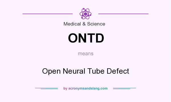 What does ONTD mean? It stands for Open Neural Tube Defect