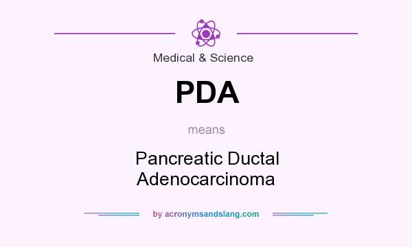 What does PDA mean? It stands for Pancreatic Ductal Adenocarcinoma