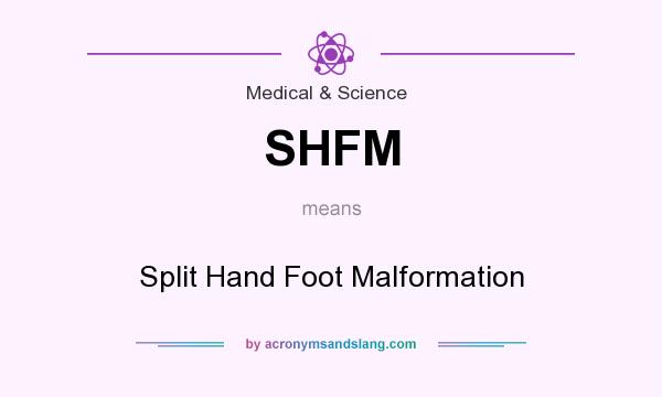 What does SHFM mean? It stands for Split Hand Foot Malformation