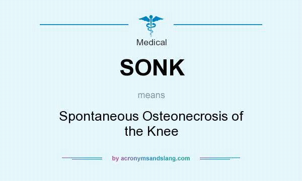 What does SONK mean? It stands for Spontaneous Osteonecrosis of the Knee