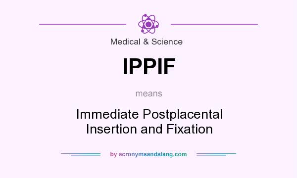What does IPPIF mean? It stands for Immediate Postplacental Insertion and Fixation
