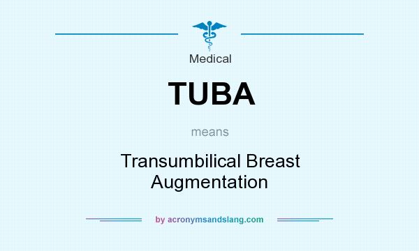 What does TUBA mean? It stands for Transumbilical Breast Augmentation