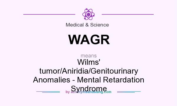 What does WAGR mean? It stands for Wilms` tumor/Aniridia/Genitourinary Anomalies - Mental Retardation Syndrome