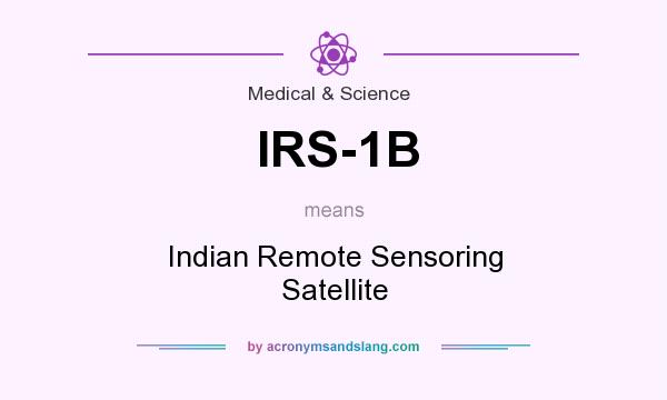 What does IRS-1B mean? It stands for Indian Remote Sensoring Satellite