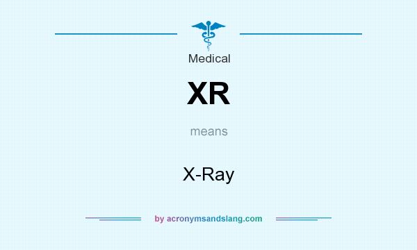 What does XR mean? It stands for X-Ray